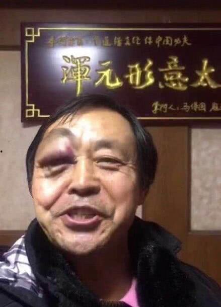 马保国最新爆料新闻视频,揭秘武术界惊人内幕! 第2张 马保国最新爆料新闻视频,揭秘武术界惊人内幕! 第2张